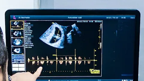 Pantalla del ultrasonido durante un estudio con el Dr. Ra&uacute;l Patl&aacute;n en Le&oacute;n
